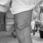 Diterkam Buaya Saat Memancing, Warga Marok Kecil Selamat Meski Alami Luka Gigitan